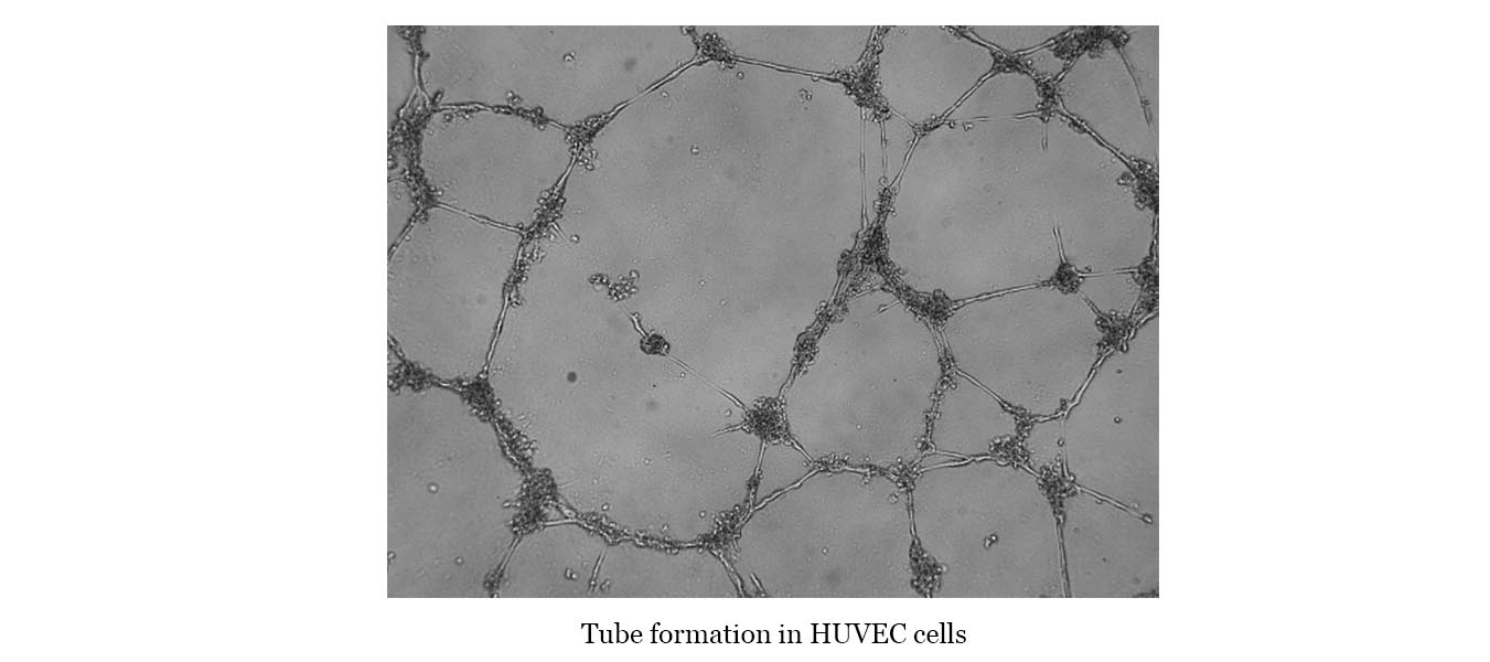 HUVEC Cells