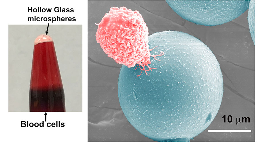 illustration of cancer cell attaching too ball