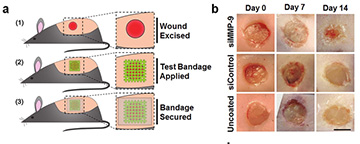  Self-Assembled Wound Dressings Silence MMP-9 and Improve Diabetic Wound Healing In Vivo