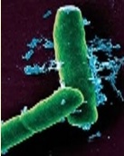 Bacillus anthracis