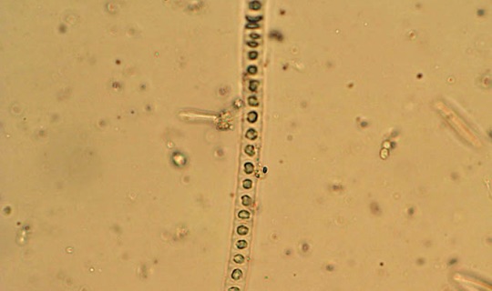 Alga