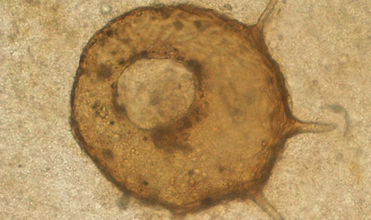 Centropyxis Aculeata