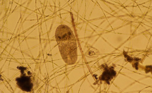 Ciliates