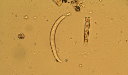 Eunotia Lunaris