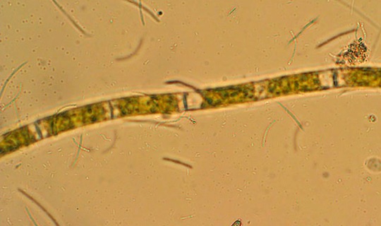 Filamentous Alga       With Bacteria