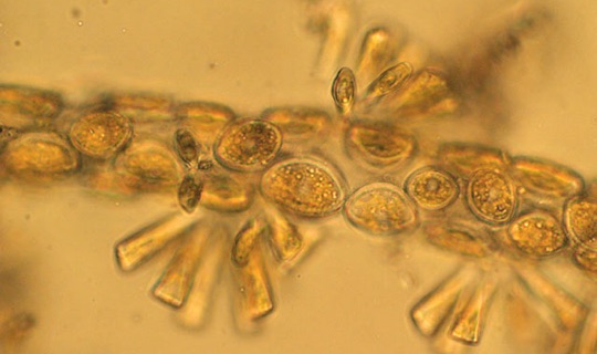 Tribonema With Cocconeis       & Rhoicosphenia