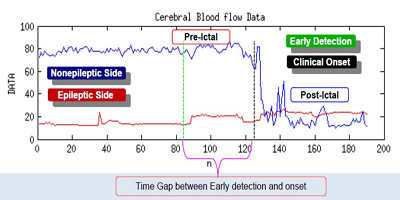 Cerebral Blood Flow Data 1