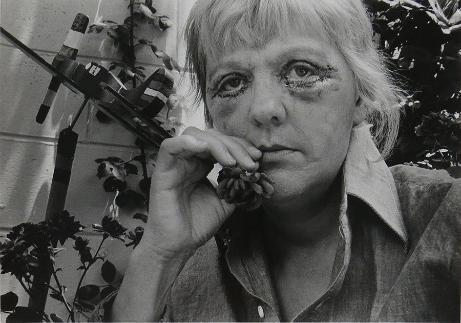 Anne Noggle, Face-lift No. 3, 1975