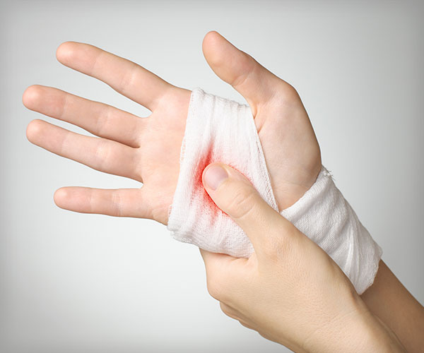 Injured hand with bloody white gauze bandage