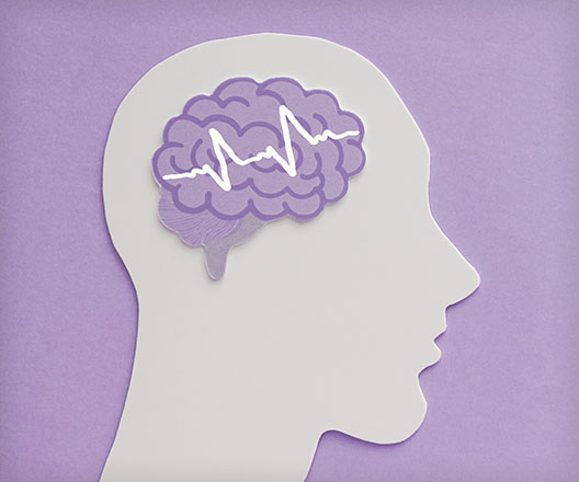 Illustration of brain with EKG line.