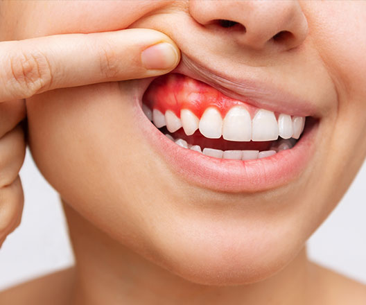 examining teeth and gums