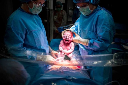 Dr Devine delivers a baby via C section