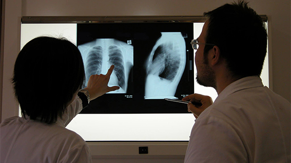 doctors discussing exrays of lungs