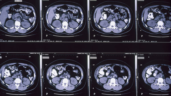 Many backlit, hanging scans of brains.